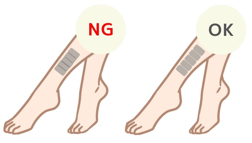 足への重複照射面がわかるイラスト NG 足への正しい照射面がわかるイラストイラスト OK